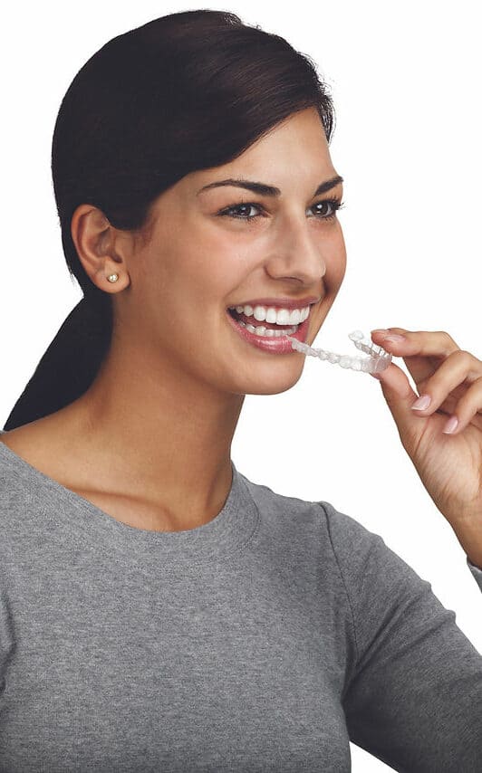 Invisalign | NA Orthodontics