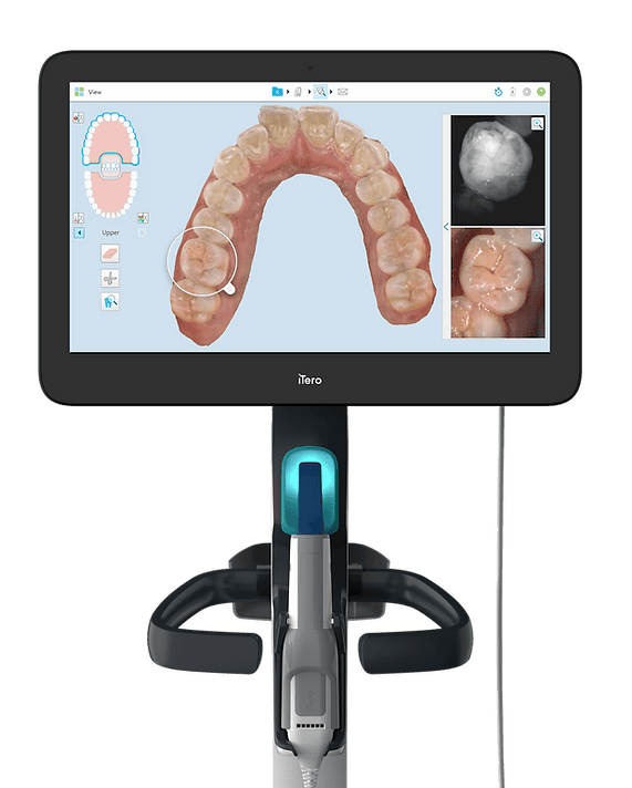 iTero Element scanner