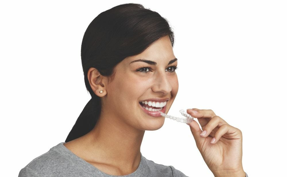 Invisalign | NA Orthodontics